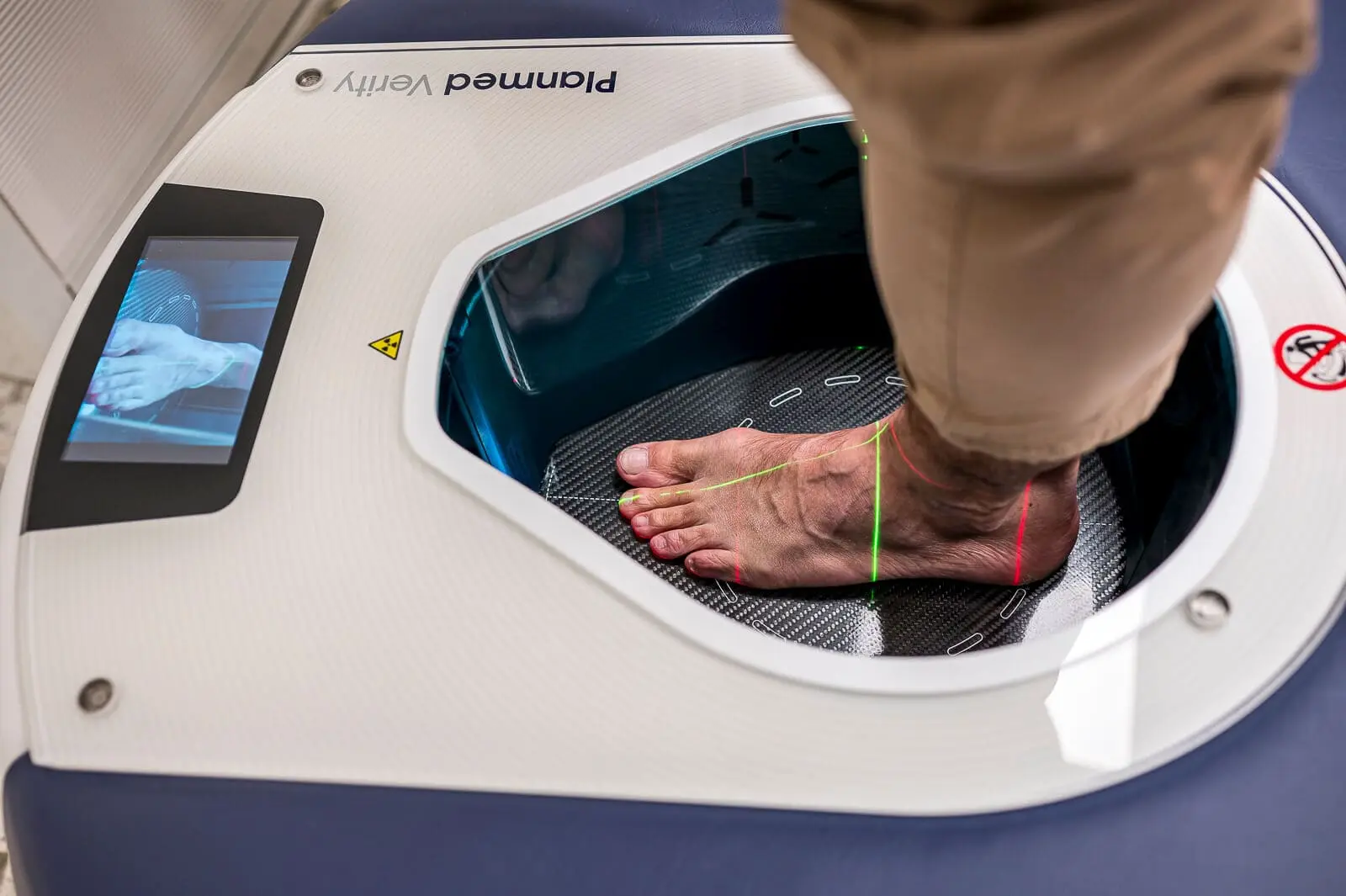 Scanner 3D numérique pour analyse podologique et diagnostic des pathologies du pied et de la cheville